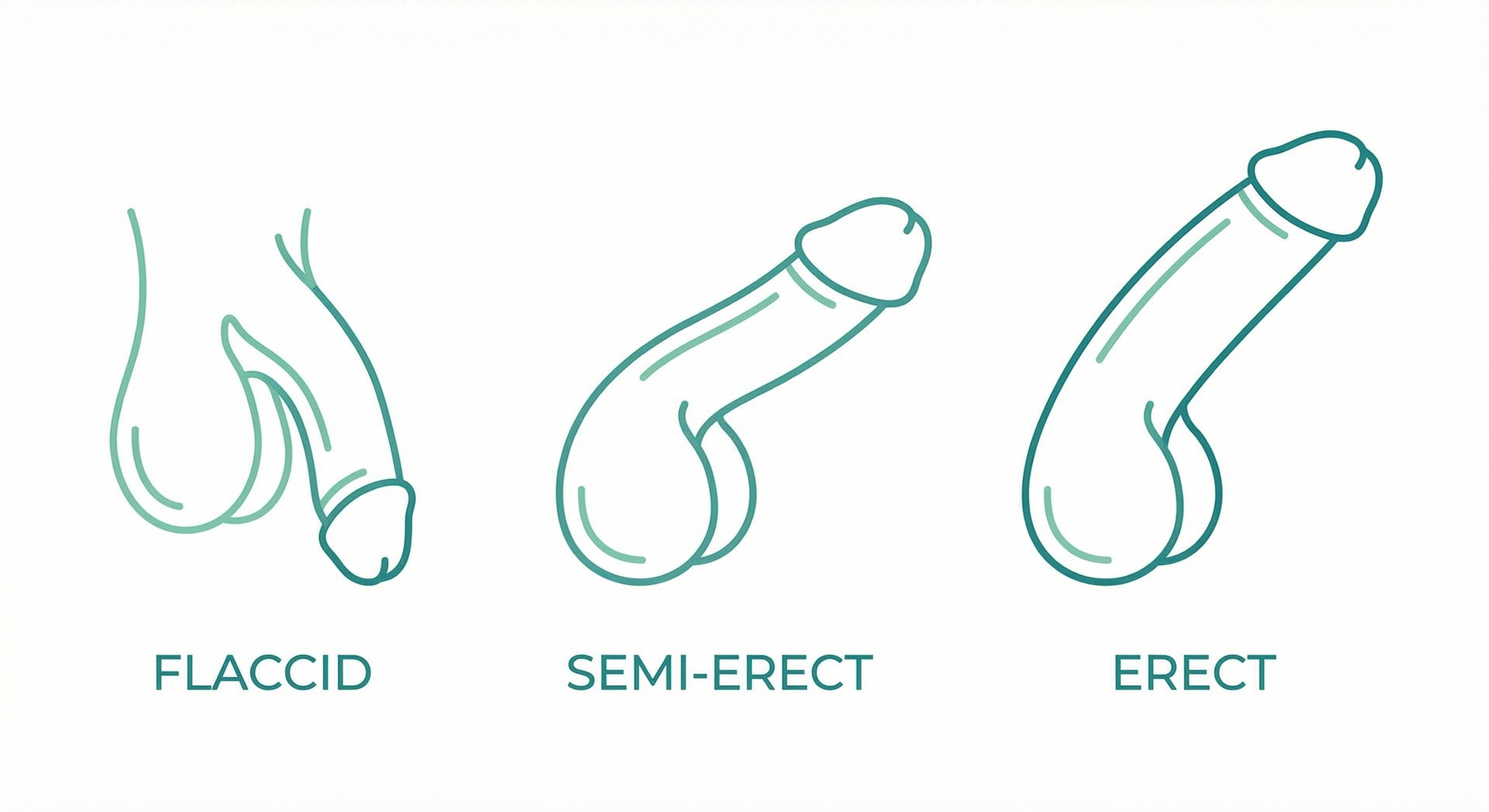 Erection states - flaccid, semi-erect, and erect
